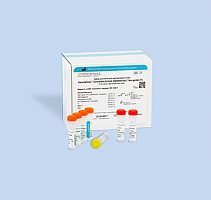 Corynebacterium diphtheriae / tox-genes-FL. Качественное определение ДНК Corynebacterium diphtheriae и обнаружение генов, кодирующих токсины Corynebacterium diphtheriae и Corynebacterium ulcerans