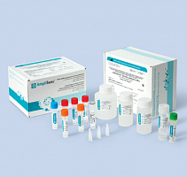Bacillus anthracis-FRT. Выявление Bacillus anthracis